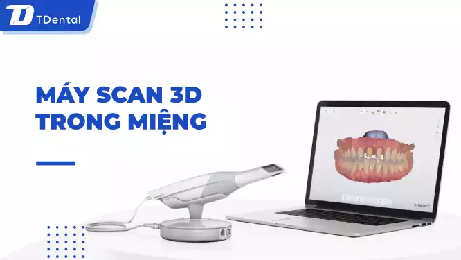 máy scan 3d trong miệng