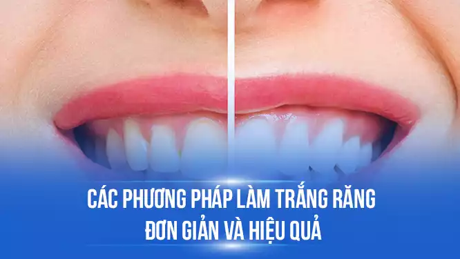 tdental.vn